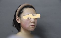 体验后-圣嘉新医疗美容医院