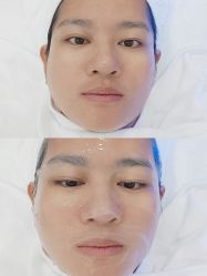 -慕颜医疗美容·皮肤微整 抗衰