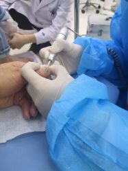 -派恩宜灰指甲鸡眼嵌甲手足癣