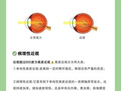 -北京华德眼科医院