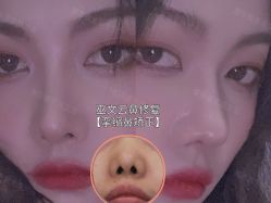 -北京米扬丽格医疗美容·联合丽格鼻整形中心