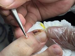 -新甲连锁灰指甲·甲沟炎·鸡眼(黑龙江路店)