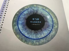 -成都新视界眼科医院·近视手术·儿童近视
