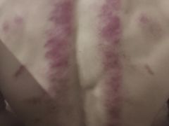 -小朱点穴推拿