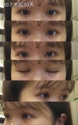 -成都西区医院整形美容