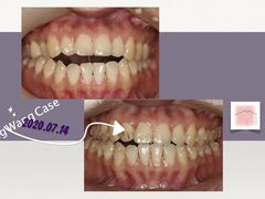 -齐玉齿科JADENTAL