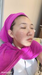 -北京米扬丽格医疗美容·联合丽格鼻整形中心