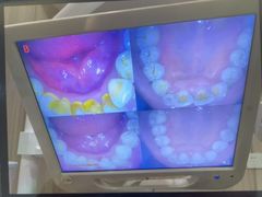 -土豆口腔(凤凰北总店)