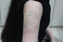 -雲艺刺青·洗纹身