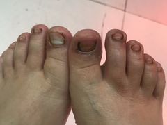 -新甲连锁灰指甲·甲沟炎·鸡眼(黑龙江路店)