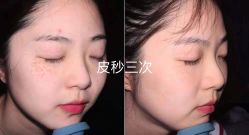 -上海漾颜医疗美容