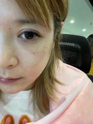 体验前-针美汇欧邦医疗美容