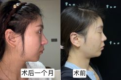 -JustHer宁波珈禾医疗美容医院