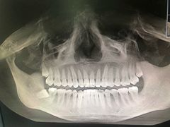 -上海市杨浦区牙病防治所