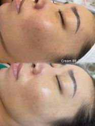 -Cream88颜皮肤管理中心