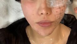 -坤如玛丽·医疗美容中心