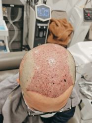 -熙朵美学植发·连锁品牌