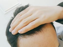 -雍禾植发全国连锁