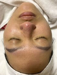 -JNK皮肤管理中心