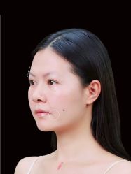 -Yestar艺星医疗美容医院