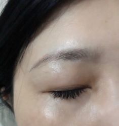-初樱科技美学问题肌修复中心