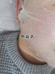 点击看大图 -Yestar宁波艺星整形医院