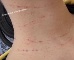 -深圳春天阳光医院·轮廓抗衰中心