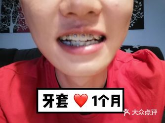 【案例分享】今天我们来讲个小帅哥的正畸案例