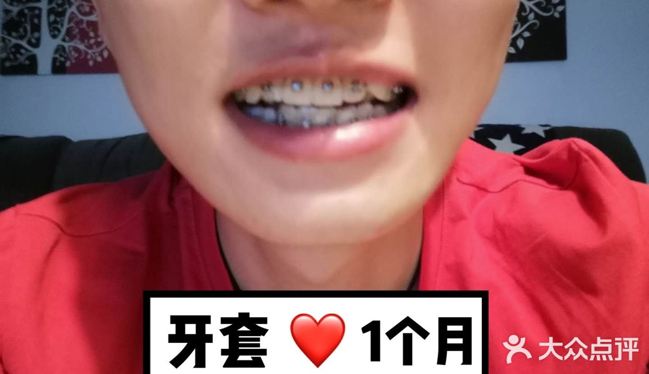 【案例分享】今天我们来讲个小帅哥的正畸案例