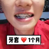 【案例分享】今天我们来讲个小帅哥的正畸案例