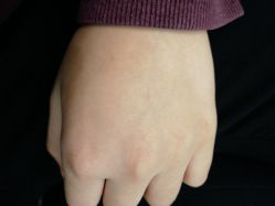 -咪咪专业脱毛连锁机构