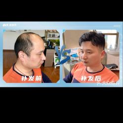 -极客侠男士假发定制补发