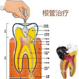 牙髓病和根尖周病首选根管治疗