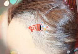 -大麦微针植发全国连锁