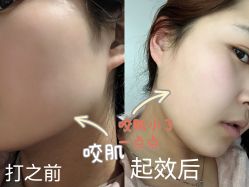 -安徽合肥韩美整形外科医院