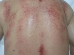 -金蚁康•经络调理•肩颈按摩(万达金街店)