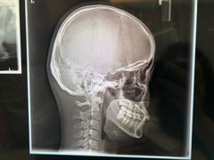 -同步齿科·数字化正畸种植口腔中心(珠海店)