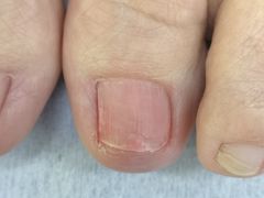 -Andrew指甲专科灰指甲·甲沟炎矫正·3D步态矫形鞋垫定制(上海法华镇路旗舰店)
