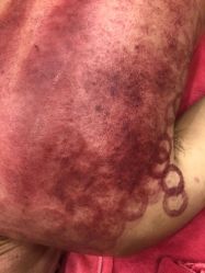 -兰派国际美容养生SPA