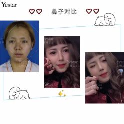 -Yestar艺星医疗美容医院