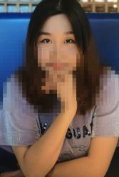 体验后-SKINIST丽铂医疗美容