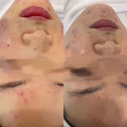 -SKIN79皮肤管理中心