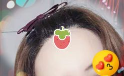 -大麦微针植发全国连锁