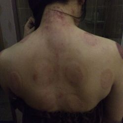 -香榭丽舍·海菲秀·皮肤管理痘敏肌修护
