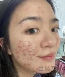 点击看大图 -痘敏医生专业祛痘·肌肤修复连锁