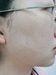 -素美医疗美容·西南眼鼻整形·修复基地