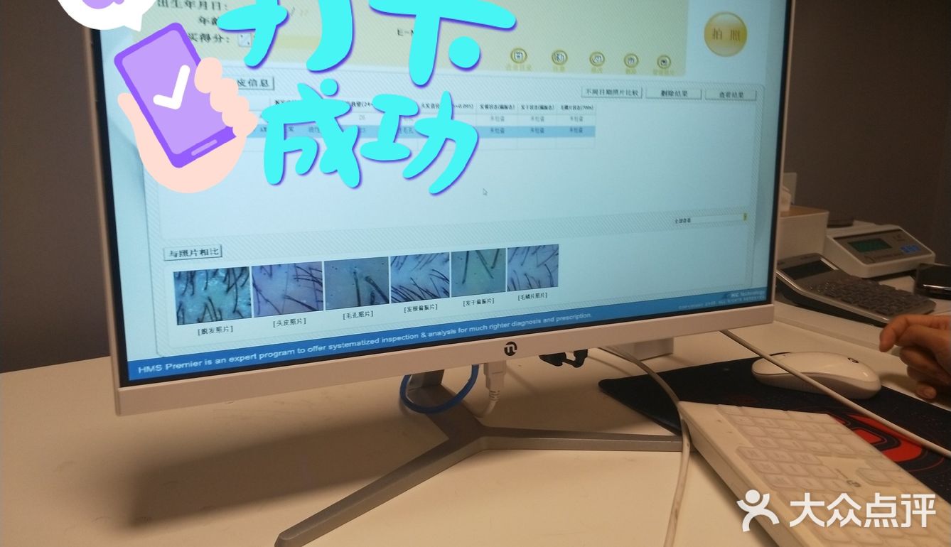 首次体验头皮护理[胜利]