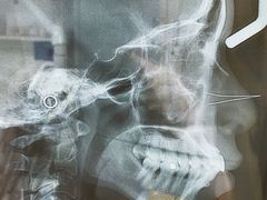 -浙江大学医学院附属第二医院(解放路院区)