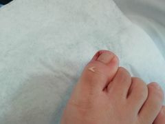 -世龙世家灰指甲鸡眼脚气甲沟炎跖疣护理(通州店)