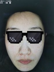 点击看大图 体验前-天津伊美尔医疗整形美容专科医院